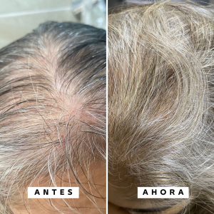 Dúo Crecimiento & Anticaída