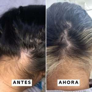 Kit Anticaída Full